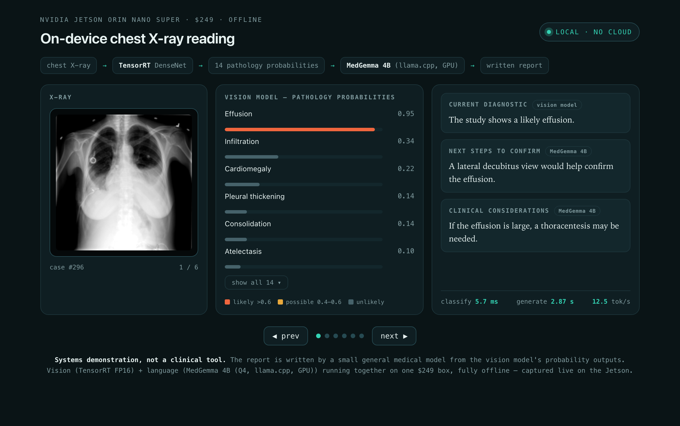 Reading station with three report boxes: current findings (from the vision model), next steps to confirm and clinical considerations (both from MedGemma). Effusion scores 0.95, the findings read 'likely effusion' and the next step is a lateral decubitus view.